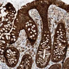 Immunohistochemical staining of human colon shows strong cytoplasmic positivity in glandular cells.