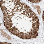 Immunohistochemical staining of human testis shows strong cytoplasmic positivity in cells in seminiferous ducts.