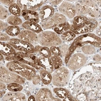 Immunohistochemical staining of human kidney shows moderate to strong cytoplasmic positivity in cells in tubules.