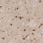 Immunohistochemical staining of human cerebral cortex shows strong cytoplasmic positivity in astrocytes.