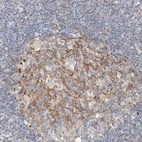 Immunohistochemical staining of human lymph node shows strong membranous positivity in germinal center cells.