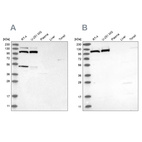 Western blot analysis using Anti-MTHFD1L antibody HPA029040 (A) shows similar pattern to independent antibody HPA029041 (B).