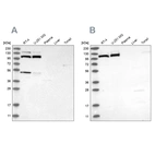 Western blot analysis using Anti-MTHFD1L antibody HPA029040 (A) shows similar pattern to independent antibody HPA029041 (B).