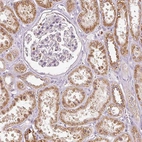 Immunohistochemical staining of human kidney shows moderate to strong granular cytoplasmic positivity in cells in tubules.