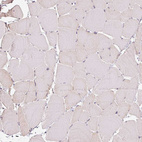 Immunohistochemical staining of human skeletal muscle shows weak positivity in myocytes.