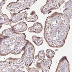 Immunohistochemical staining of human placenta shows moderate granular cytoplasmic positivity in trophoblastic cells.