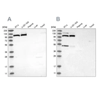 Western blot analysis using Anti-MTHFD1L antibody HPA029041 (A) shows similar pattern to independent antibody HPA029040 (B).
