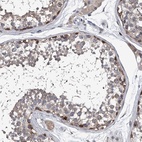 Anti-PPP2R5D Antibody