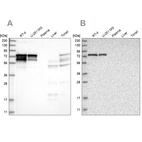 Western blot analysis using Anti-PPP2R5D antibody HPA029045 (A) shows similar pattern to independent antibody HPA029046 (B).