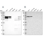 Western blot analysis using Anti-PPP2R5D antibody HPA029045 (A) shows similar pattern to independent antibody HPA029046 (B).