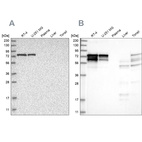 Western blot analysis using Anti-PPP2R5D antibody HPA029046 (A) shows similar pattern to independent antibody HPA029045 (B).