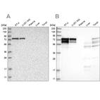 Western blot analysis using Anti-PPP2R5D antibody HPA029046 (A) shows similar pattern to independent antibody HPA029045 (B).