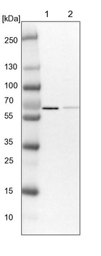 Anti-PPP2R5D Antibody