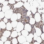 Anti-FBXO5 Antibody