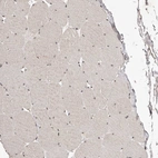 Immunohistochemical staining of human Skeletal muscle shows no positivity in myocytes as expected.