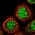Immunofluorescent staining of human cell line A-431 shows localization to nucleoplasm.