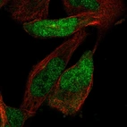 Anti-ZNF518A Antibody