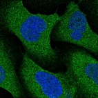 Anti-NRBP2 Antibody