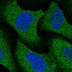 Immunofluorescent staining of human cell line U-2 OS shows localization to cytosol.