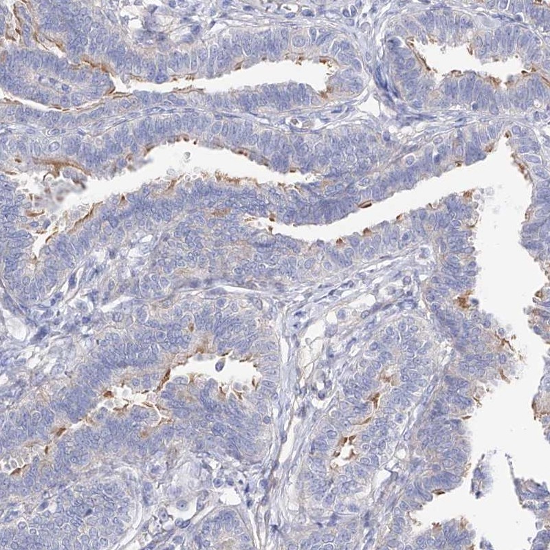 Anti-LCA5 Antibody