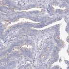 Anti-LCA5 Antibody