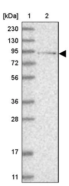 Lane 1: Marker [kDa] 230, 130, 95, 72, 56, 36, 28, 17, 11_br/_Lane 2: Human cell line RT-4