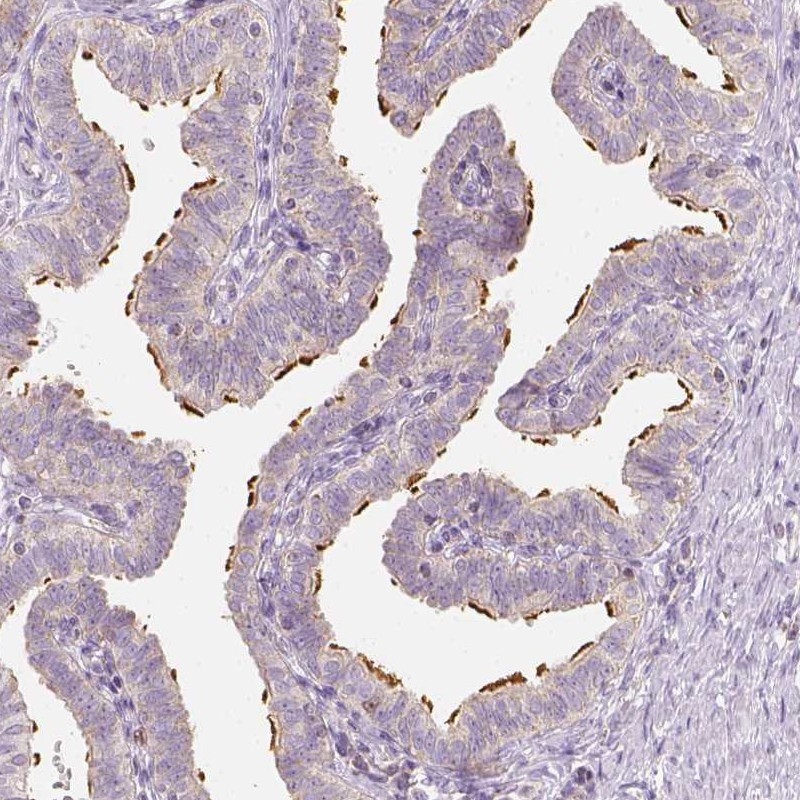 Anti-LCA5 Antibody