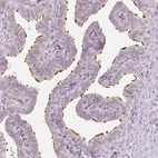 Anti-LCA5 Antibody