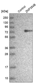 Anti-ZNF354B Antibody