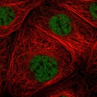 Immunofluorescent staining of human cell line A-431 shows localization to nucleoplasm.