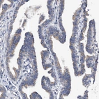 Immunohistochemical staining of human fallopian tube shows moderate cytoplasmic positivity in glandular cells.