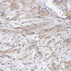 Immunohistochemical staining of human prostate shows weak cytoplasmic positivity in smooth muscle cells.