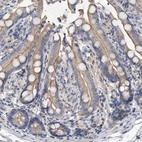Immunohistochemical staining of human colon shows weak cytoplasmicand moderate membranous positivity in glandular cells.