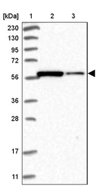 Lane 1: Marker [kDa] 230, 130, 95, 72, 56, 36, 28, 17, 11_br/_Lane 2: Human cell line RT-4_br/_Lane 3: Human cell line U-251MG sp