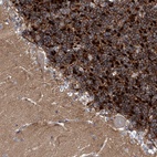 Anti-KCND2 Antibody