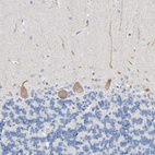 Anti-BPTF Antibody