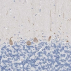 Anti-BPTF Antibody