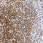 Immunohistochemical staining of human adrenal gland shows moderate cytoplasmic positivity in glandular cells.