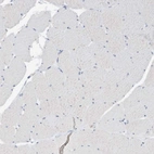 Immunohistochemical staining of human skeletal muscle shows weak to moderate positivity in myocytes.
