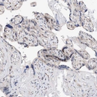 Immunohistochemical staining of human placenta shows weak to moderate nuclear positivity in trophoblastic cells.