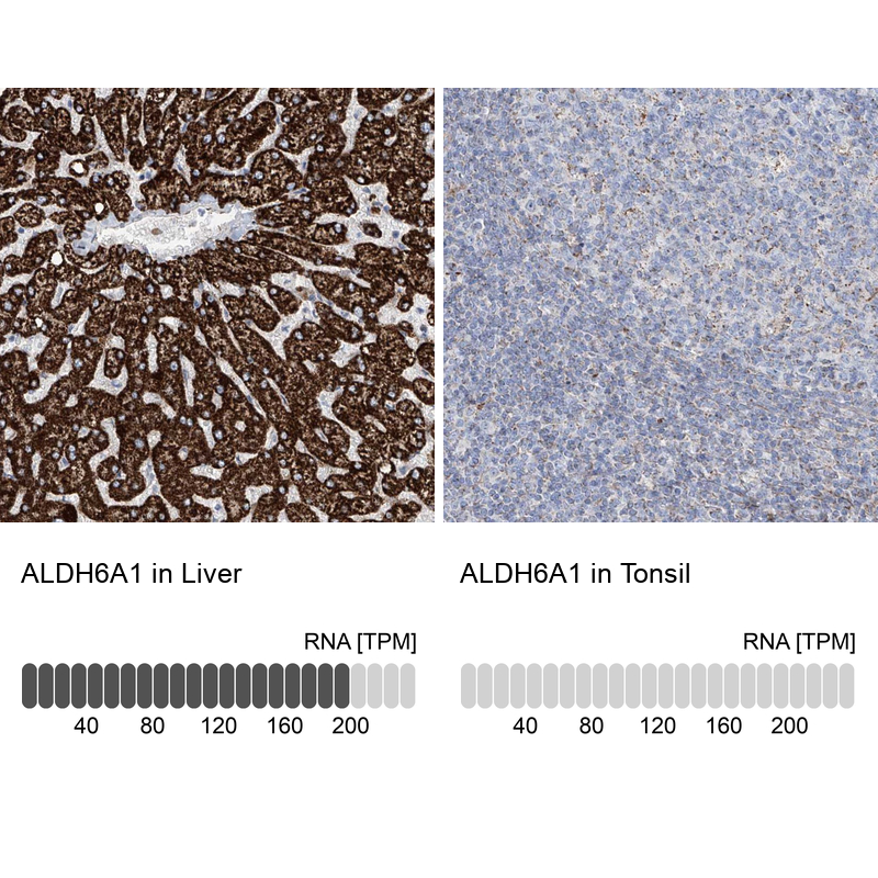 Anti-ALDH6A1 Antibody