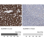 Anti-ALDH6A1 Antibody