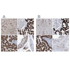 Immunohistochemical staining of human cerebral cortex, kidney, liver and testis using Anti-ALDH6A1 antibody HPA029072 (A) shows similar protein distribution across tissues to independent antibody HPA029073 (B).