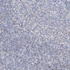 Immunohistochemical staining of human tonsil shows low expression as expected.
