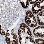 Immunohistochemical staining of human kidney using Anti-ALDH6A1 antibody HPA029072.