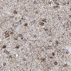 Immunohistochemical staining of human cerebral cortex using Anti-ALDH6A1 antibody HPA029072.