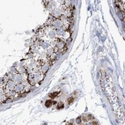 Immunohistochemical staining of human testis using Anti-ALDH6A1 antibody HPA029072.