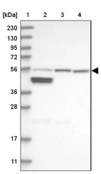 Lane 1: Marker [kDa] 230, 130, 95, 72, 56, 36, 28, 17, 11_br/_Lane 2: Human cell line RT-4_br/_Lane 3: Human cell line U-251MG sp_br/_Lane 4: Human plasma (IgG/HSA depleted)