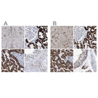 Immunohistochemical staining of human cerebral cortex, kidney, liver and testis using Anti-ALDH6A1 antibody HPA029073 (A) shows similar protein distribution across tissues to independent antibody HPA029072 (B).