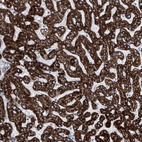 Anti-ALDH6A1 Antibody